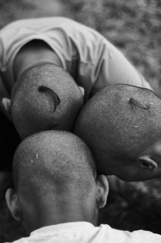 The Science of the Scalp: Why It’s Different from the Rest of Your Skin